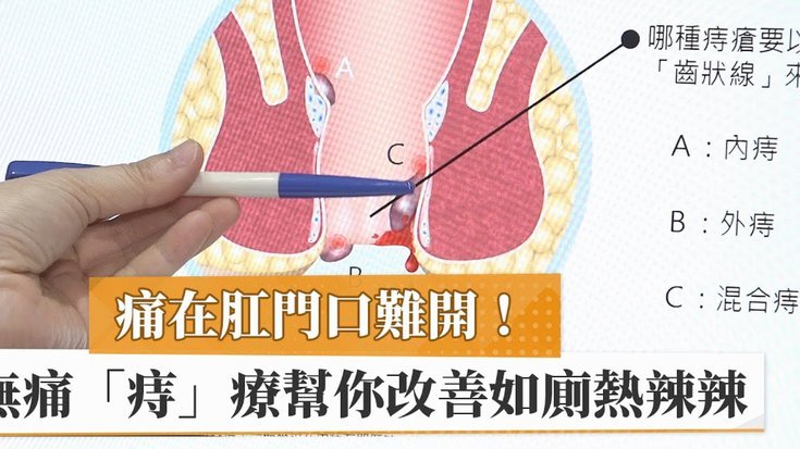 白条逾期怎么协商延期